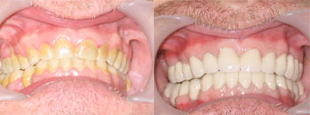 Before and After - Sacred Heart Dental Clinic