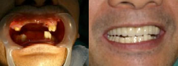 Before and After - Sacred Heart Dental Clinic