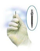 Mini Dental Implants